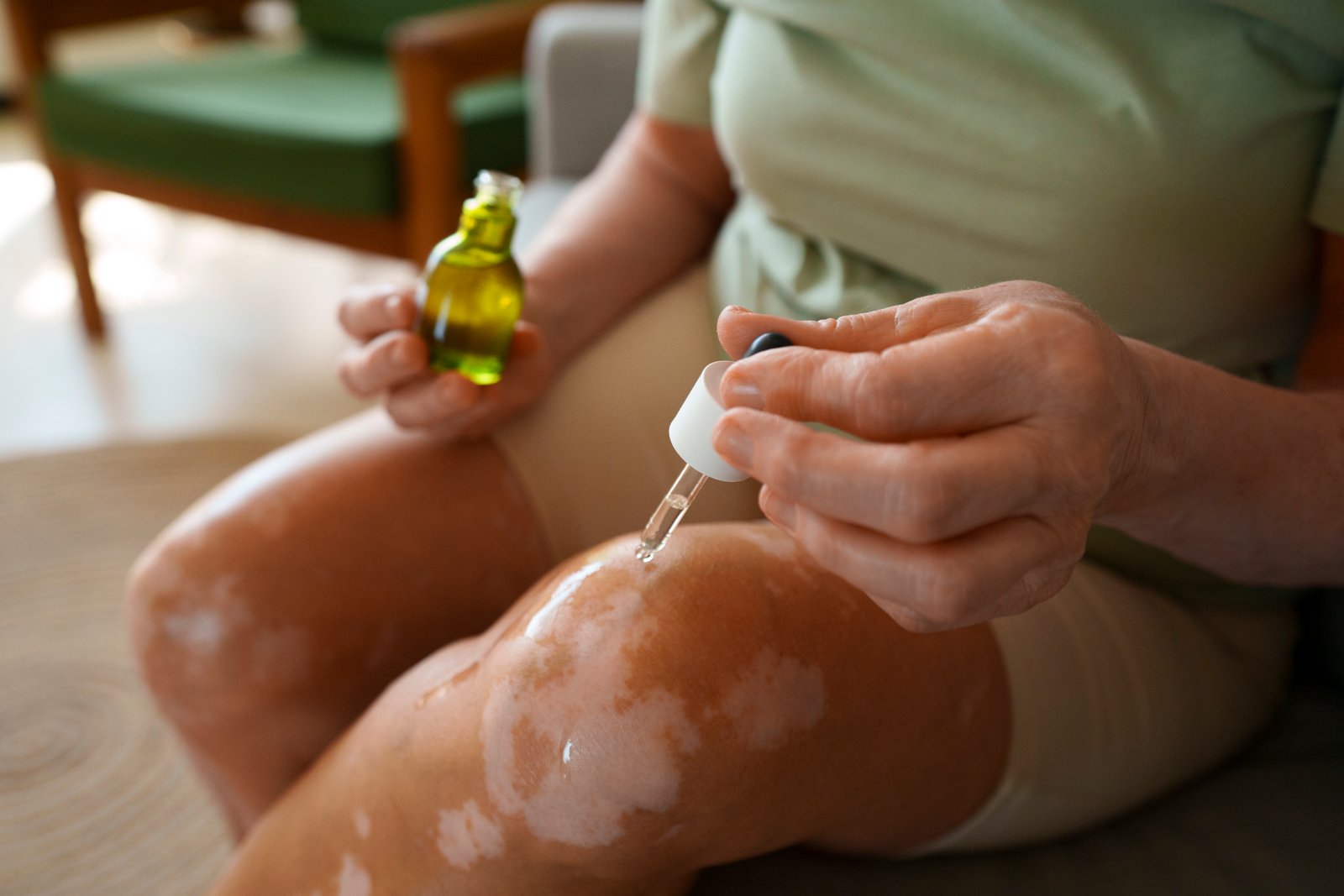 Skin Disease Treatment